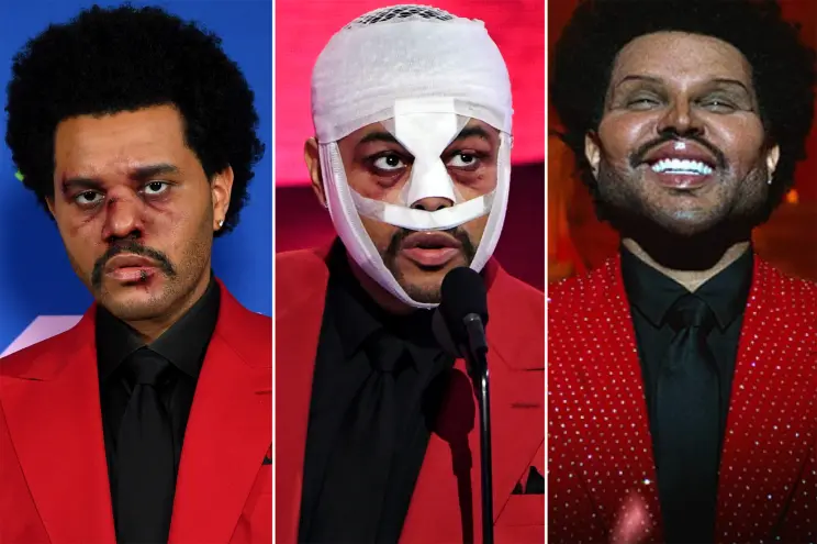 Weeknd Finally Explains His Face’s Recent Journey